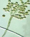 Cladosporium 