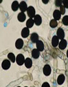 Nigrospora