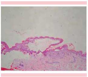 figura 2