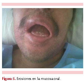 figura 2