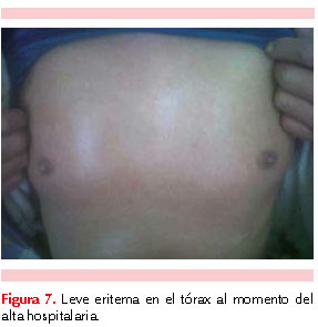 figura 2